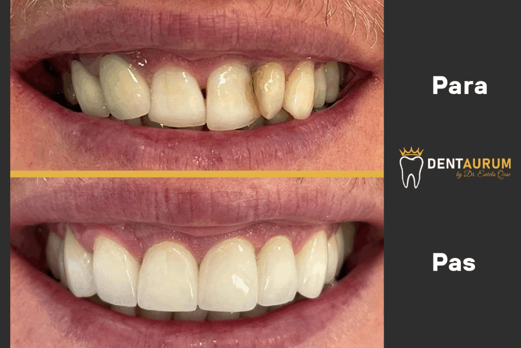 Kujdesi për dhëmbët